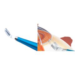 Feather Disposable Crescent Knife