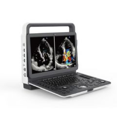 M5 Portable Ultrasound Machine - Zoncare